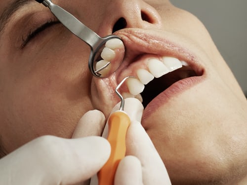 The Role of Emergency Dentists in Providing Immediate Relief